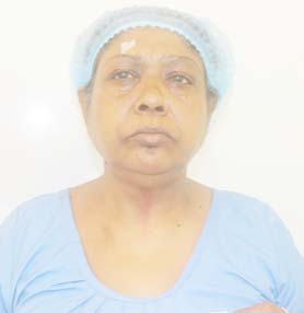 patient Image
